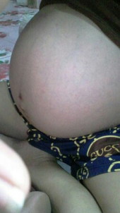 ท้องแบบนี้มีโอดาสเป็นเพศชายได้มั้ย