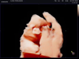 phirapan Wannakit profile icon