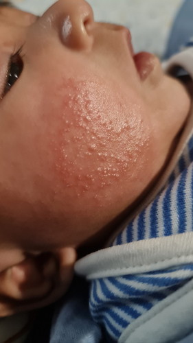 Any suggestions for skin