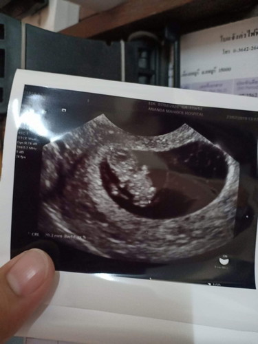 8 w หลังจากเข้าใจผิด