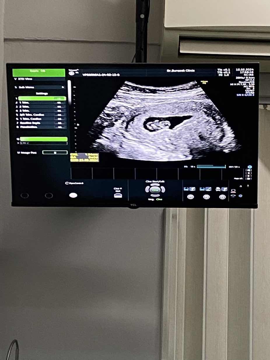 8W3D♥️ ทีมคลอดกันยา