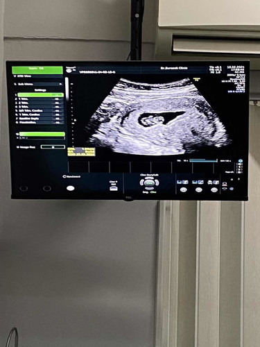 8W3D♥️ ทีมคลอดกันยา