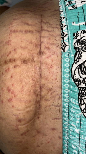 สอบถามแม่ผ่าคลอดหน่อยจ้า