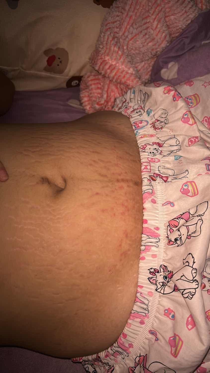 สอบถามแม่ๆหลังคลอดหน่อยค่ะ