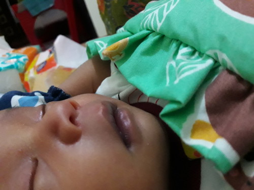 bibir jadi hitam