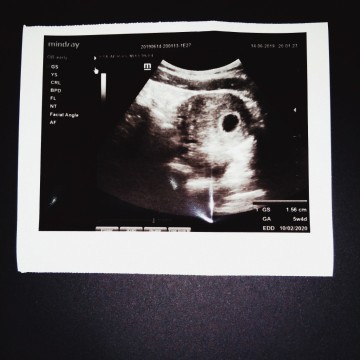 5 weeks