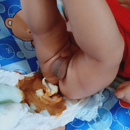 การถ่าย