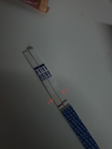 คุณแม่ท่านไหนเคยมีประสบการณ์แบบนี้บ้างค่ะ