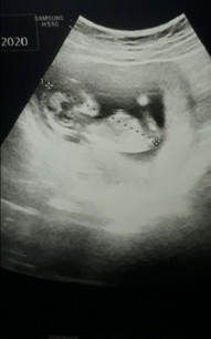 13weeks
