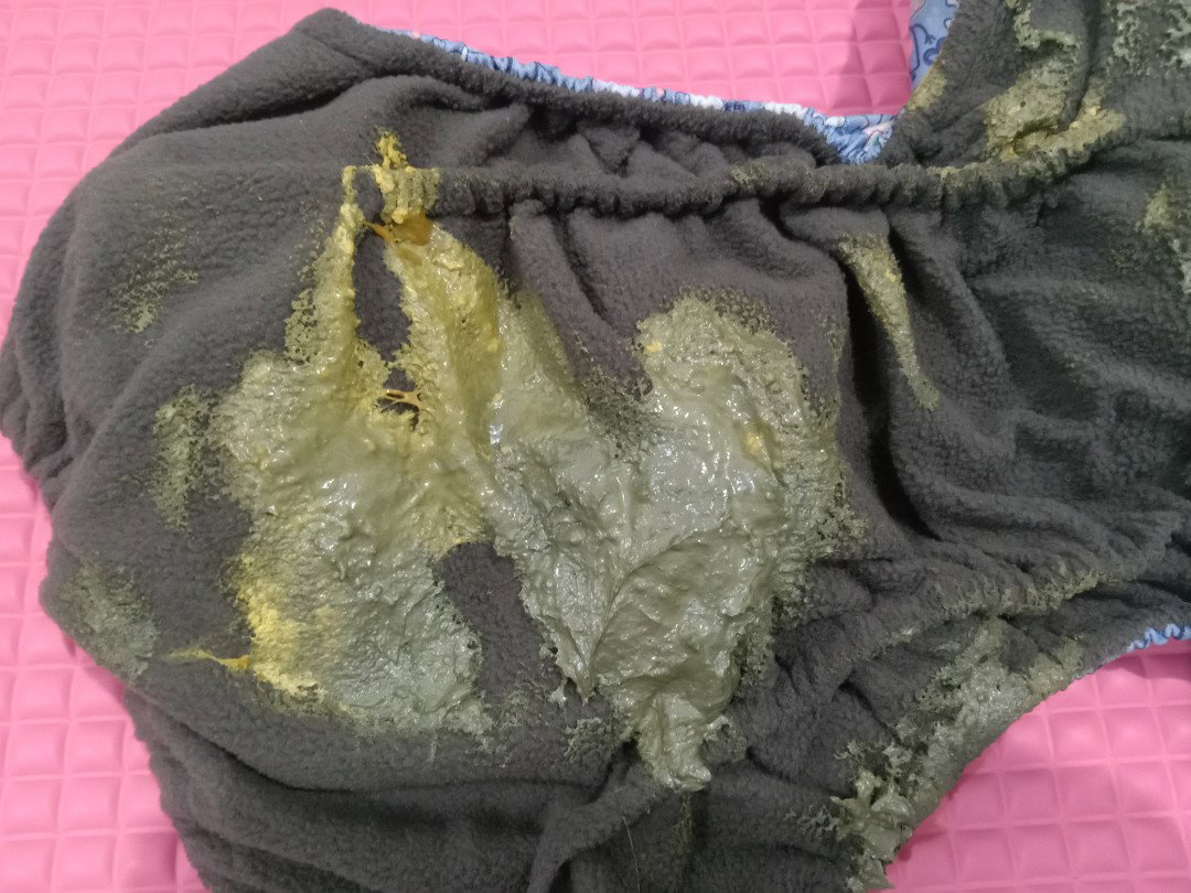 Normal color of poops