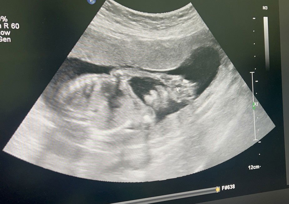 Natapohn profile icon