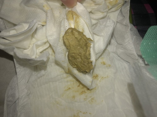 ลูกทานนมผงล้วน2วันอึทีปกติมั้ยคะ