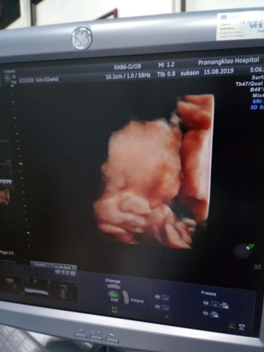 32 w ลูกตัวเล็ก