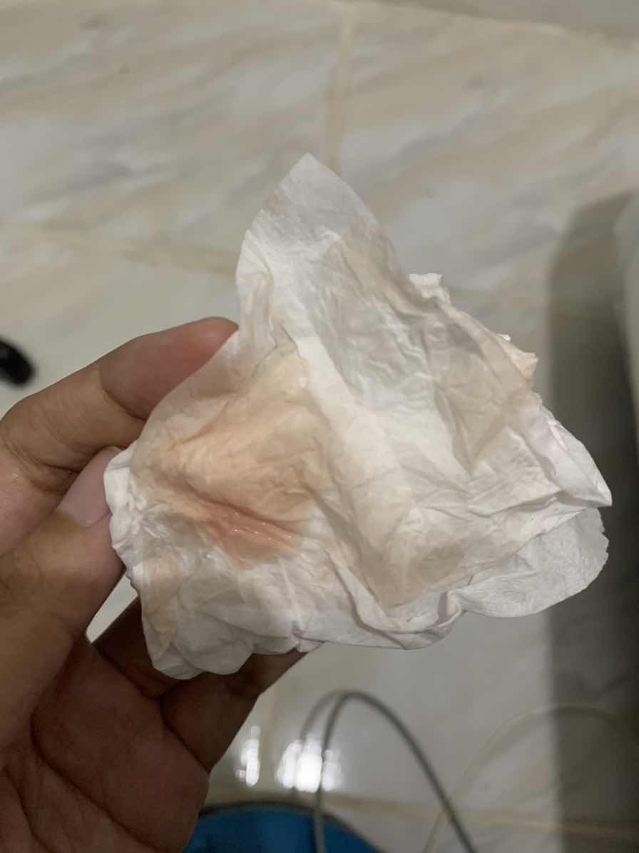 Keluar Cairan campur darah sedikit