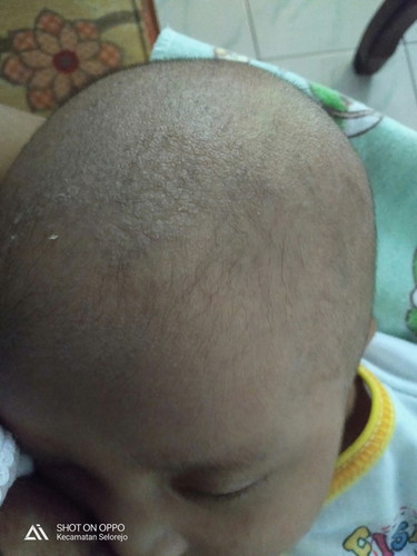 kulit kepala