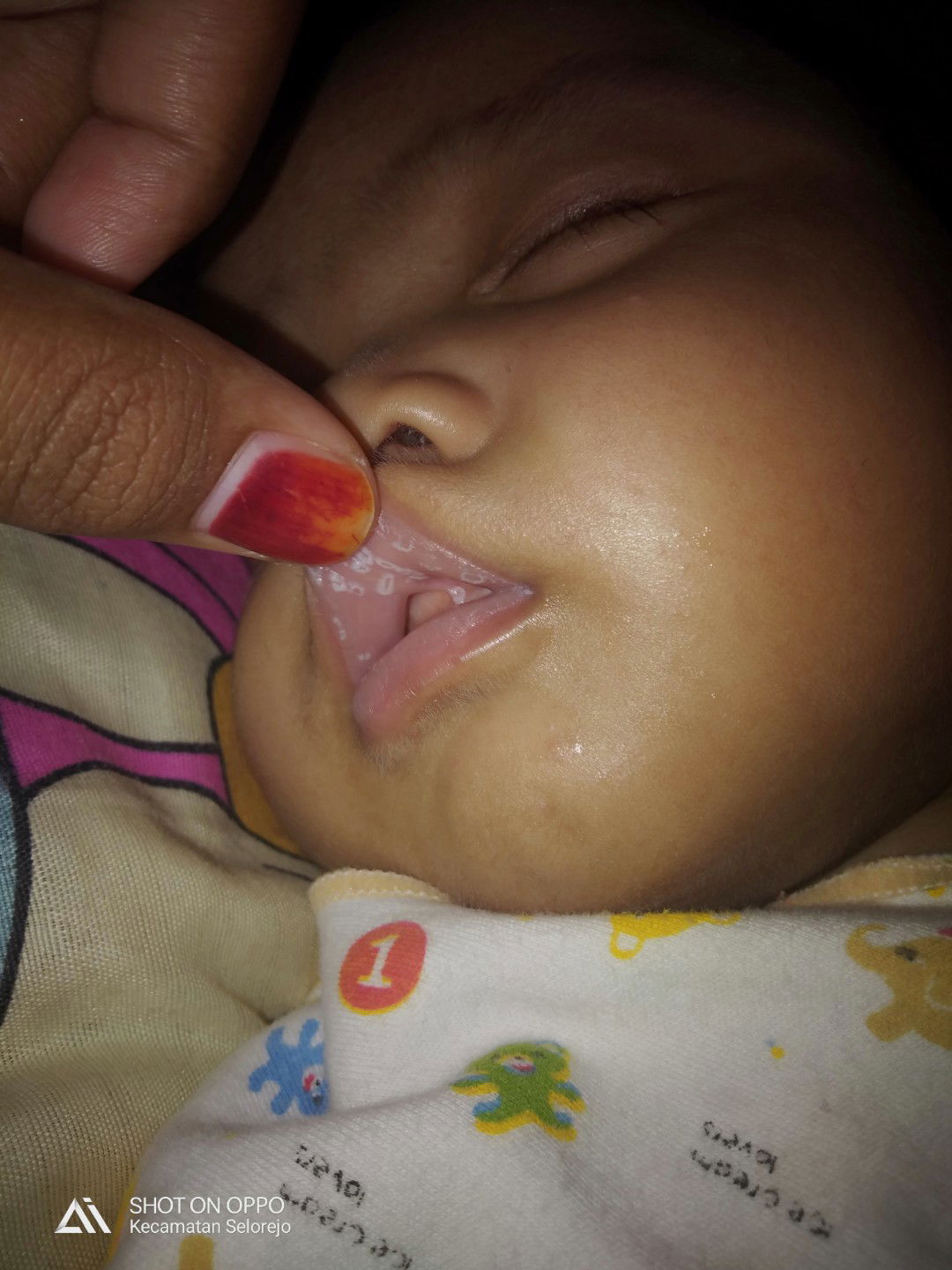 bibir bayi