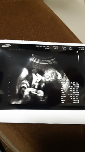 ท้อง 35 วีคกับน้ำหนักลูก