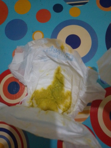 Bunda mau nnyak nih,kalo warna pup bayi kek gini normal gak ya,kuning ada kehijauan nya,bayi Newborn