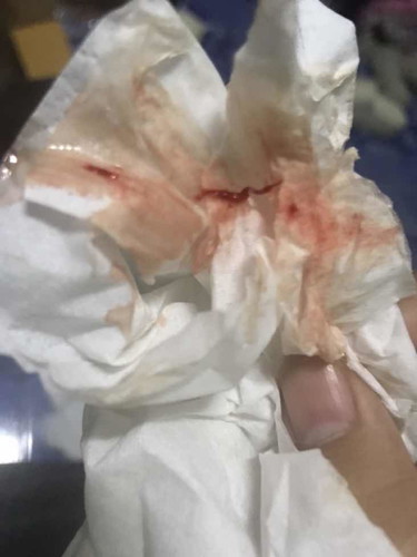 ตั้งครรภ์6สัปดาห์แล้วมีเลือดออกเป็นไรคะ