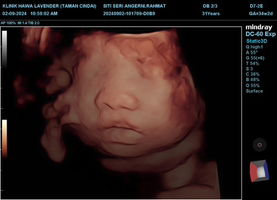 Siti seri profile icon