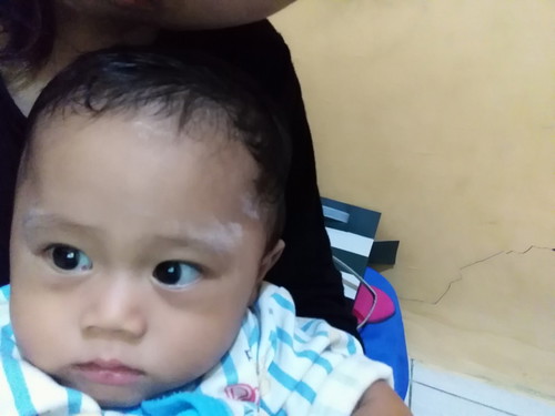 mata bayi merah bentuk kecil