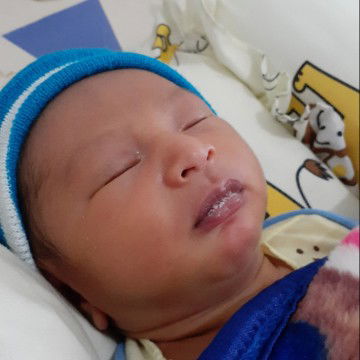 bercak putih di mulut dan lidah