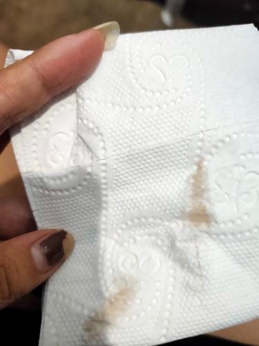 WHAT COLOR PO NG IMPLANTATION BLEEDING???