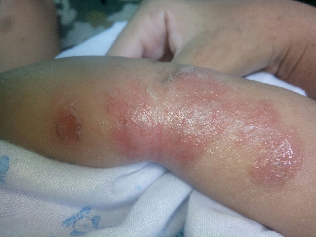 ยาทาแผล