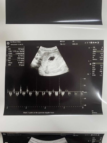 ฝากครรภ์ครั้งแรก กับ ลูกคนแรก