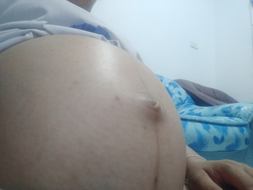 31week น้องกลับหัวแล้วจ้า