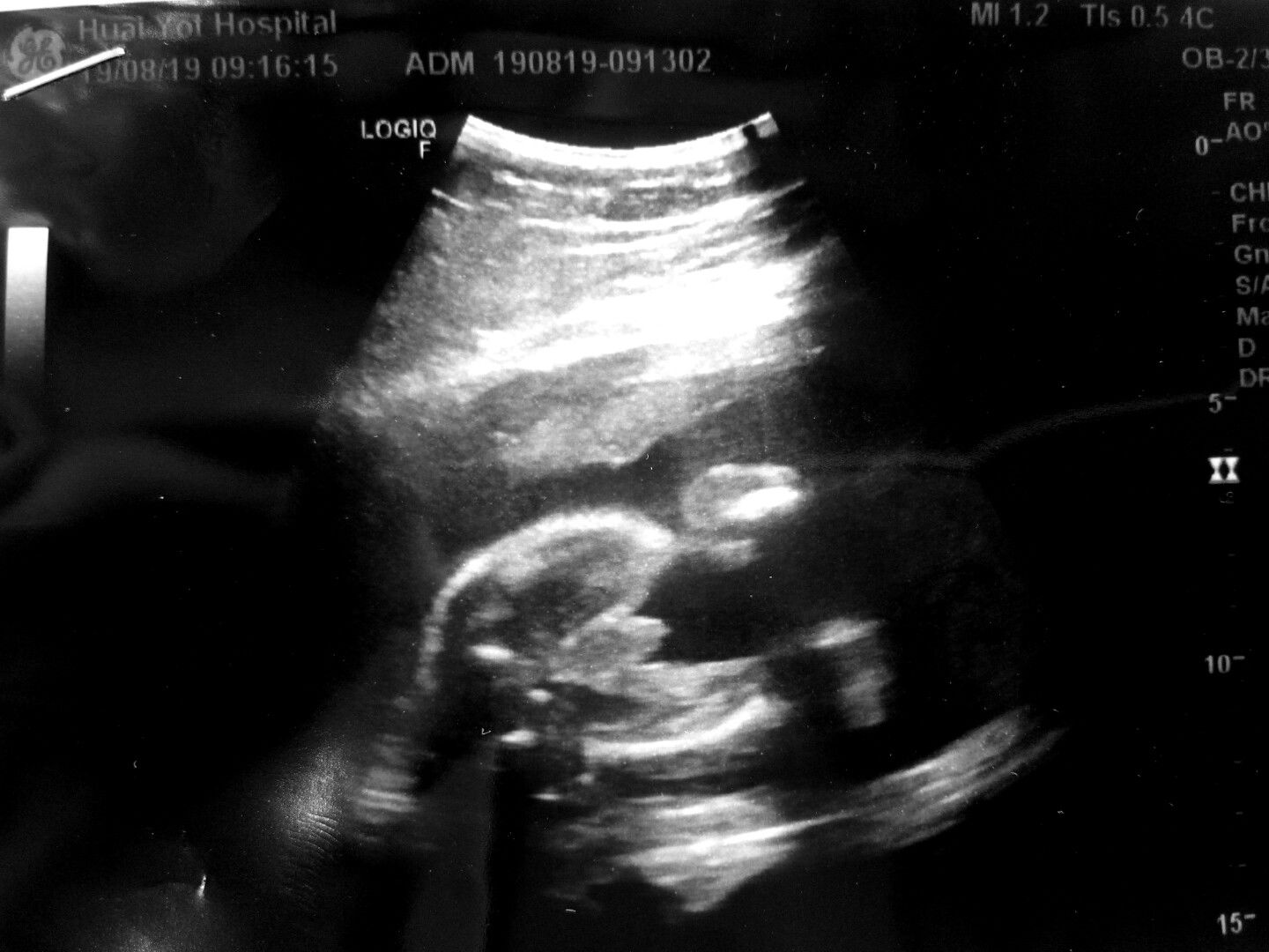 รู้เพศครั้งแรก