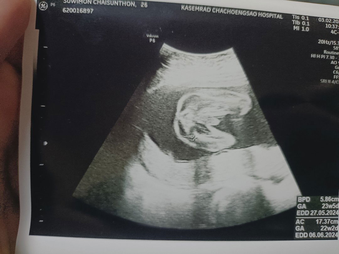 suwimol profile icon