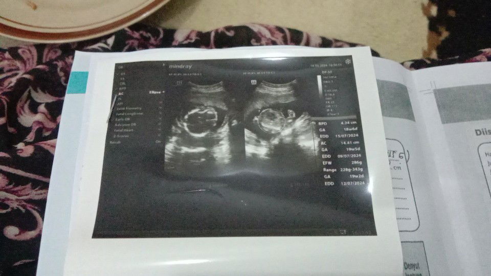 Fira Anggraini profile icon