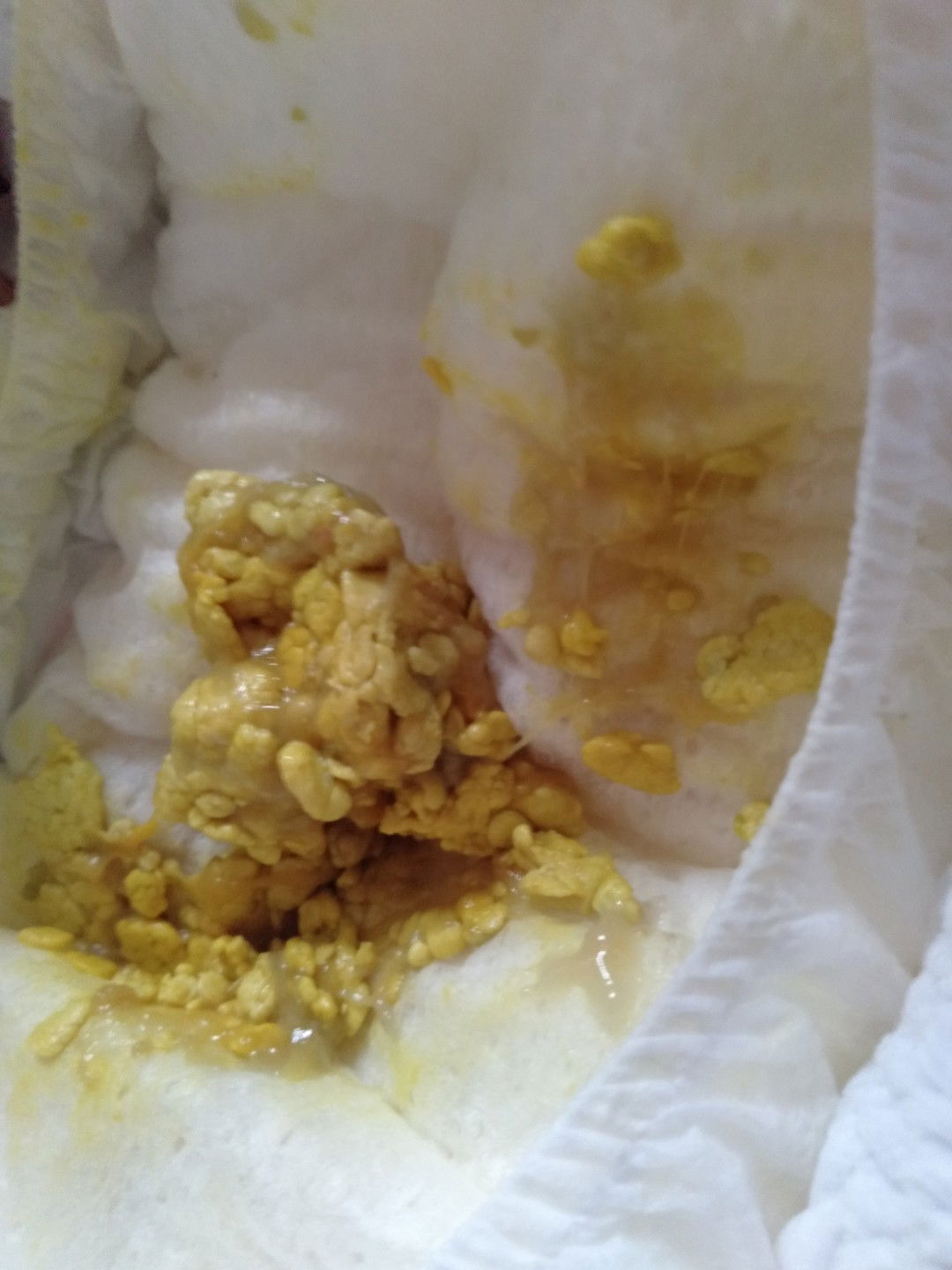 ลูกอุจจาระเป็นแบบนี้ปกติมั้ยคะ