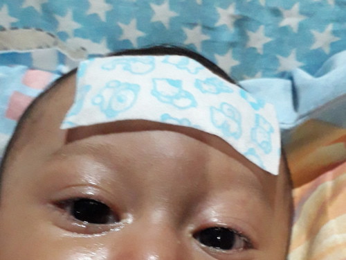 belekan / sakit mata