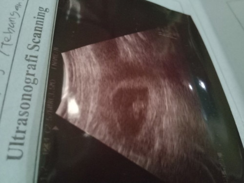 aslkm bunda