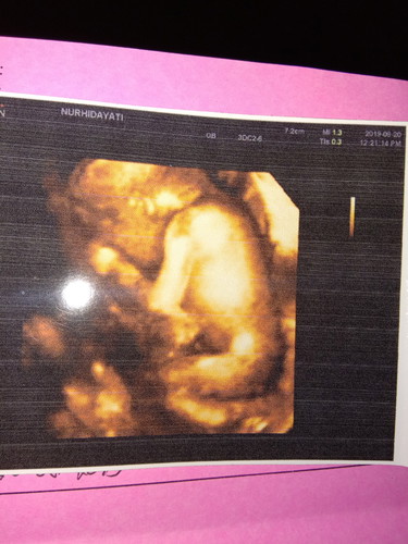 24 Week