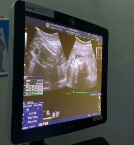 คุณแม่ท่านไหนกำหนดคลอดเดือน พค.บ้างค่ะ