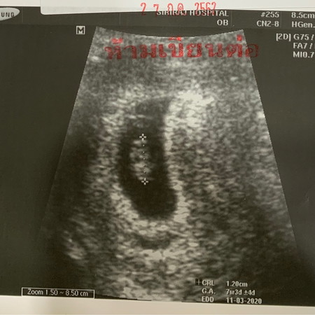 ปรากฏตัวแล้วจ้า