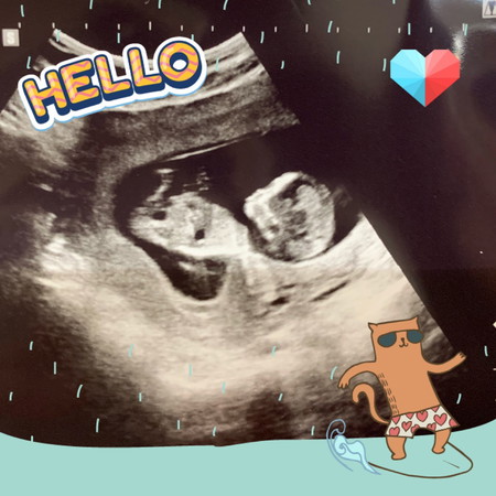 ถึง แม่ๆที่แพ้ท้องจนน้ำหนักลด จ้า