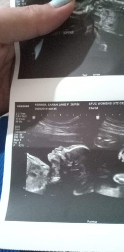 @ 24 weeks