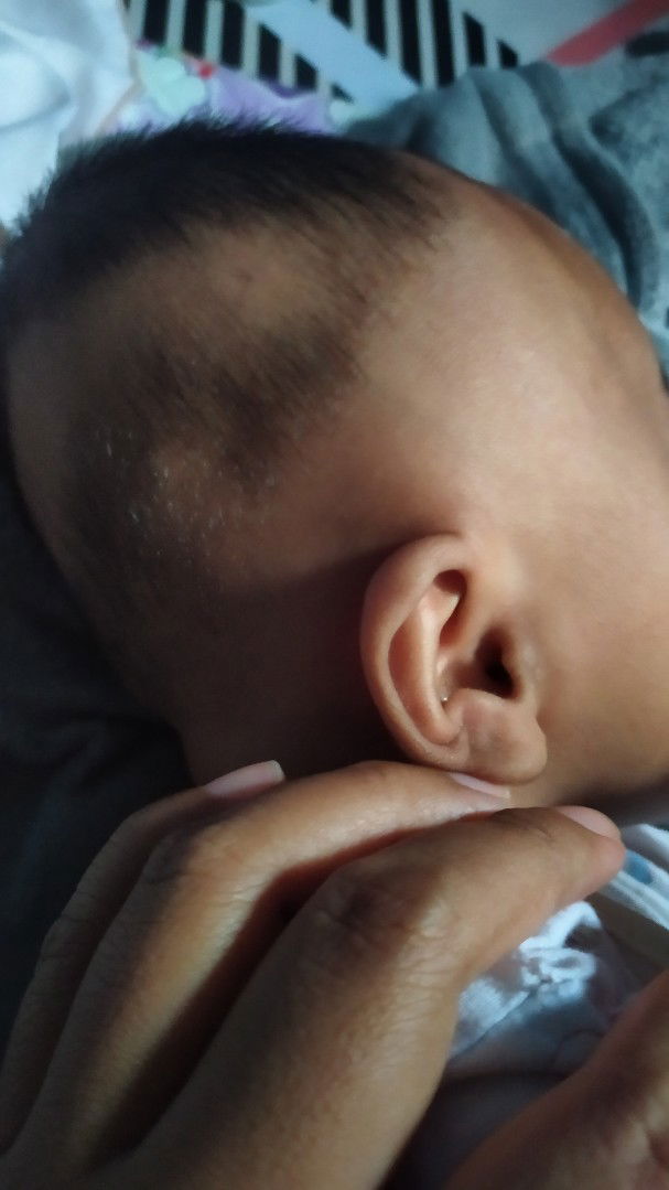 kepala bayi belakang datar usia 2bln