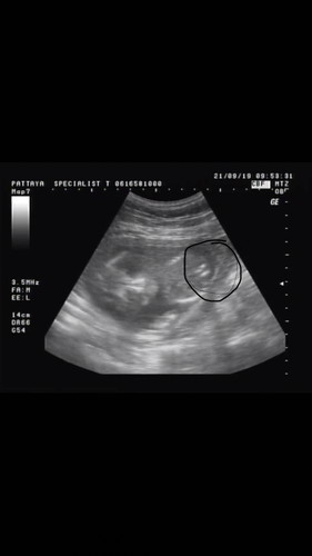 4 เดือน 6 วัน