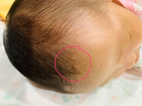 ใช้ผดร้อนหรือป่าวครับ