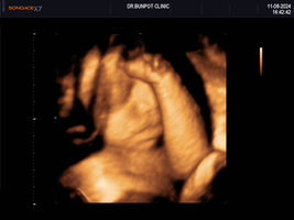 vijittra cheepubat profile icon