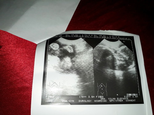 ultrasound