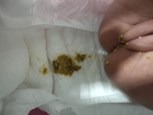 watery stool urgent question