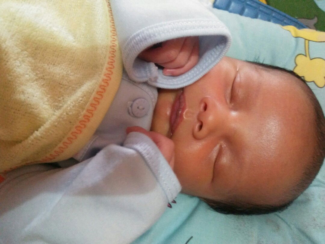 bibir bayi new born