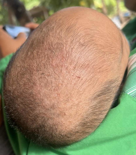 สอบถามค่า หัวน้อง