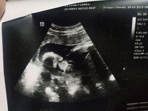 my little LJ...